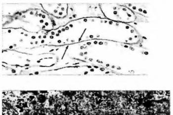 Строение и роль базафильной мембраны Тип коллагена базальных мембран и его строение